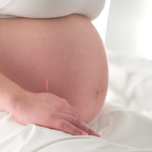 Pre-Birth Acupuncture Benefits
